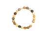 Pink Moss Agate Bracelet 8Mm